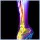 How high-heels affect a woman's leg (X-ray Photo)